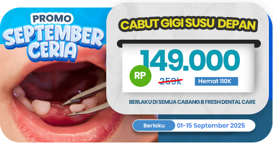 Cabut gigi susu depan